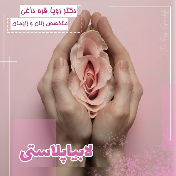 لابیاپلاستی - دکتر قره داغی