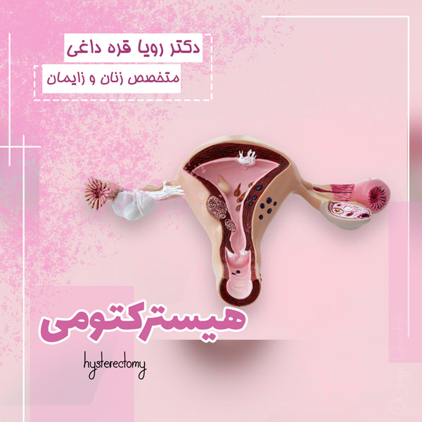 هیسترکتومی - دکتر رویا قره داغی