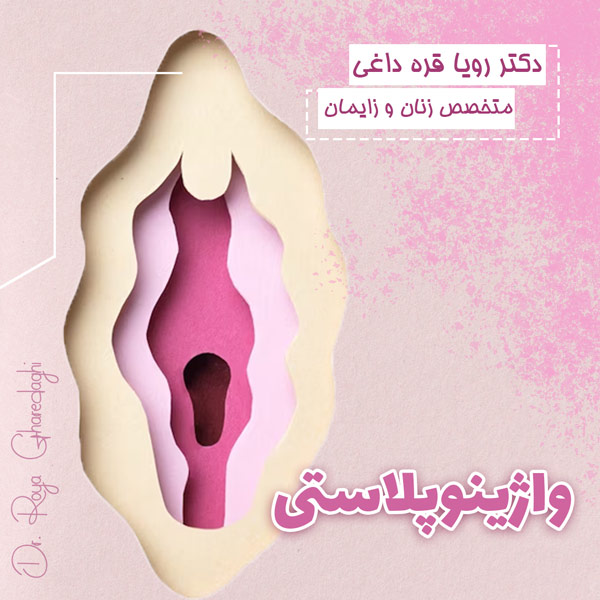 واژینوپلاستی - دکتر رویا قره داغی-dr-royagharedaghi.com