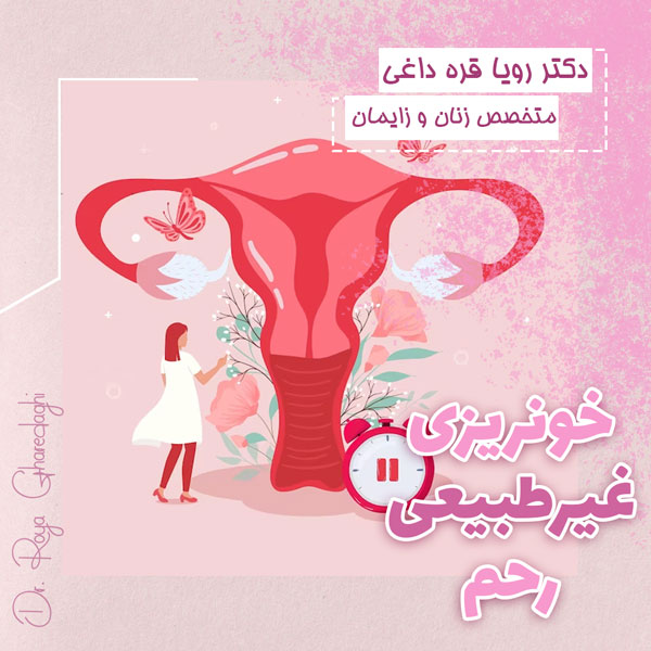 خونریزی غیرطبیعی رحم - دکتر قره داغی