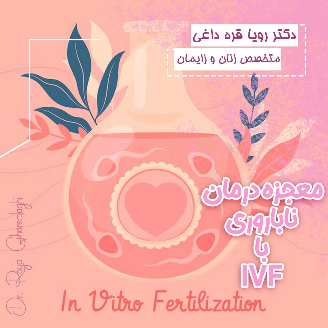 آی وی اف-دکتر رویا قره داغی