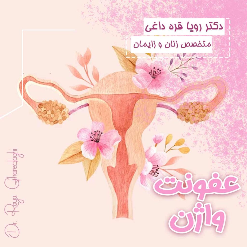 عفونت واژن-دکتر رویا قره داغی