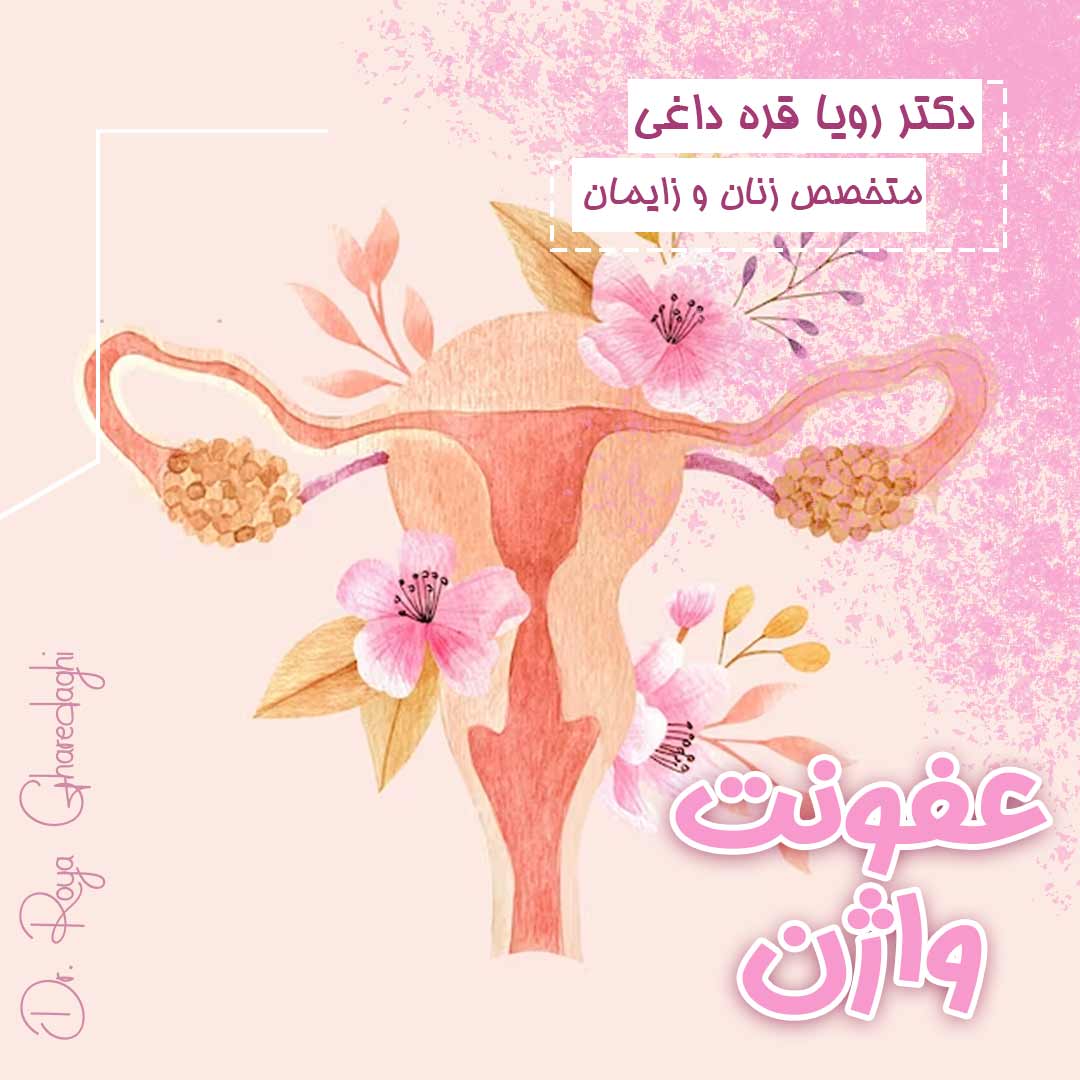 عفونت واژن-دکتر رویا قره داغی