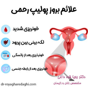 علائم پولیپ رحم - دکتر رویا قره داغی -dr-royagharedaghi.com