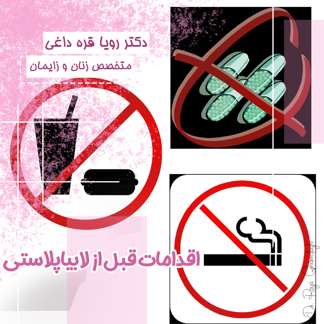 اقدامات قبل از لابیاپلاستی  - https://dr-royagharedaghi.com/