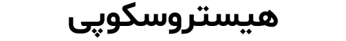 هیستروسکوپی دکتر رویا قره داغی - dr-royagharedaghi.com