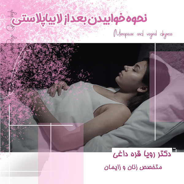 نحوه خوابیدن بعد از لابیاپلاستی