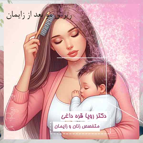 ریزش مو بعد از زایمان - دکتر رویا قره داغی -dr-royagharedaghi.com