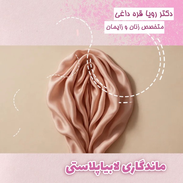 ماندگاری لابیاپلاستی چقدر است؟