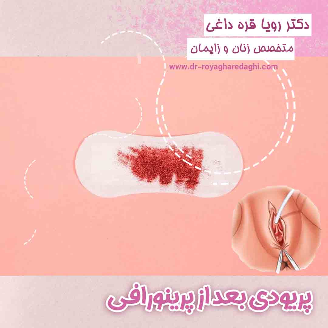 پریود بعد از پرینورافی