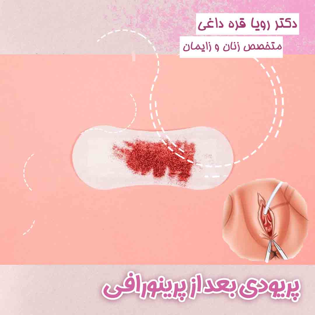 پریود بعد از پرینورافی